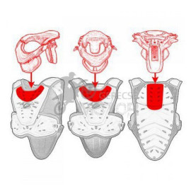 Páncél Valkyrie II rövid UFO (vállvédő nélküli)